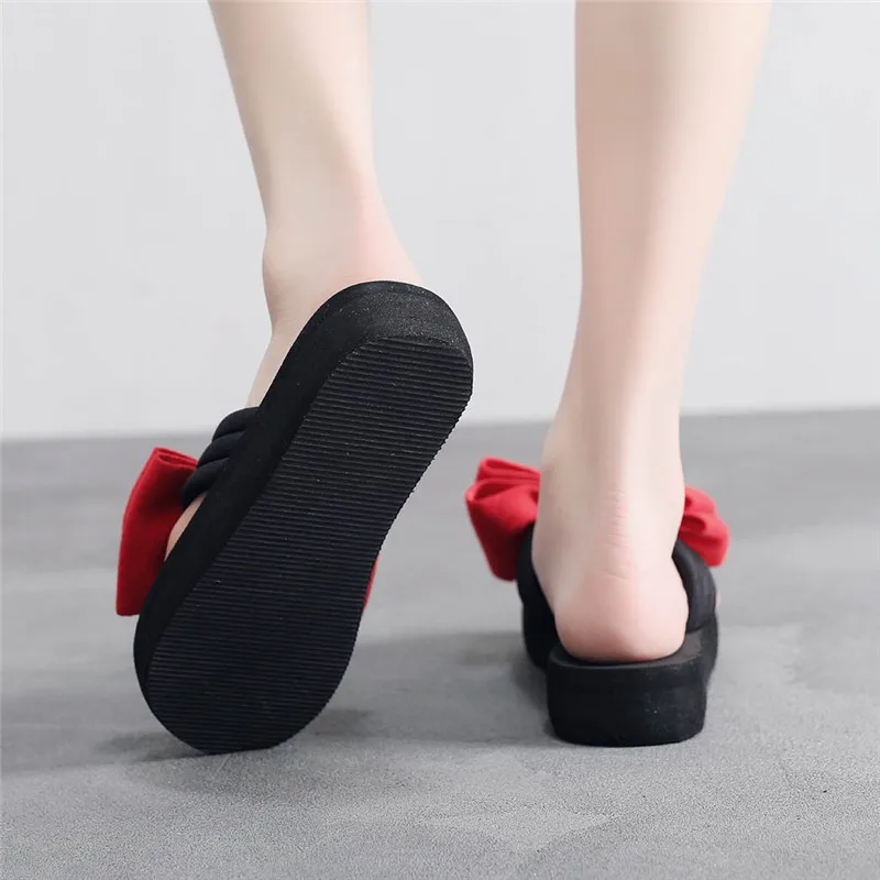 XYM81224904RD36_20181224091815538