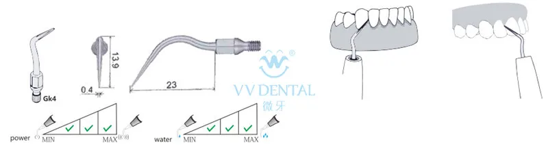 3 шт. GK4 Стоматологический Продукт supragnival масштабирование наконечник для SIRONA SIROAIR Отбеливание зубов Стоматологическое оборудование, стоматолог