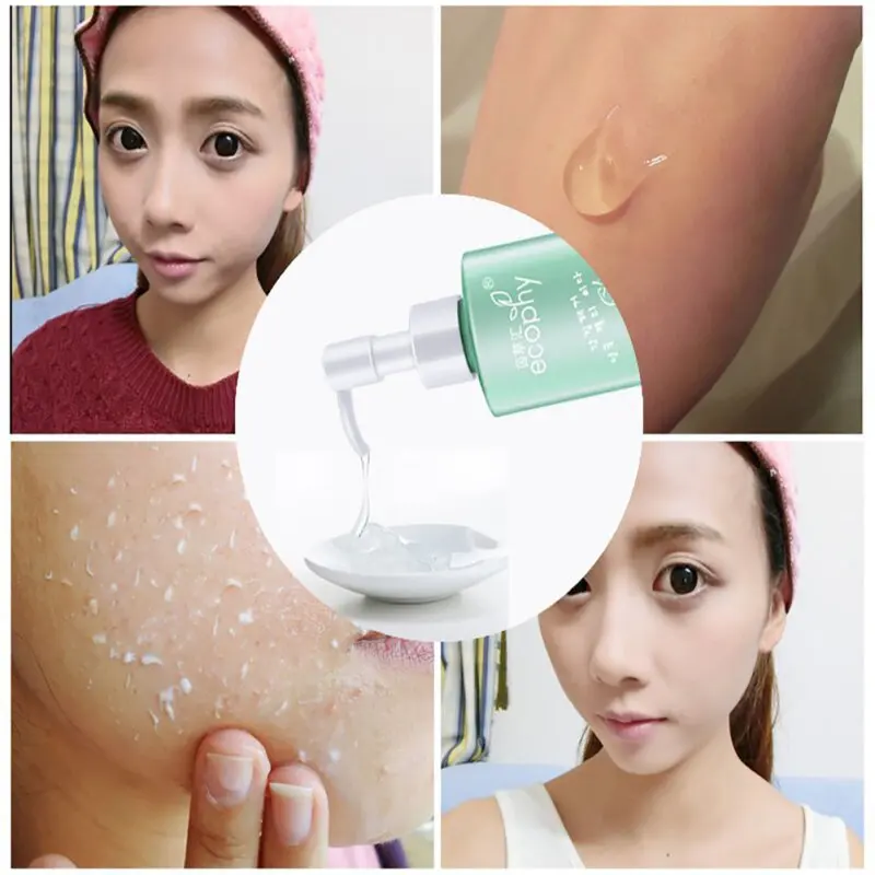 New Facial Care Products Beauty Acid Peeling Gel Exfoliating Scale Face Cleanser Facial Deep Carnation Remover
