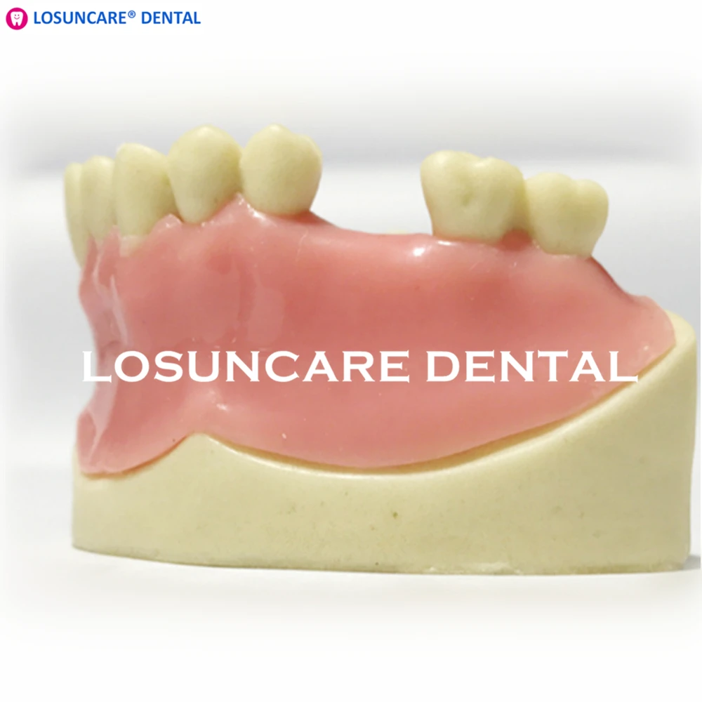 Стоматологическая модель для посадки зубов, модель имплантата нижней челюсти с мягкой десной для медицинского стоматологического образования