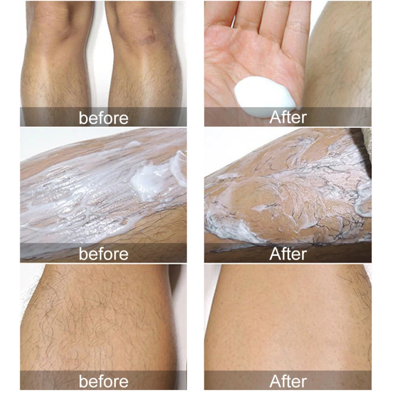 125ml Aloe Facial Beard Permanent Hair Removal Cream Stop Hair Growth Inhibitor 10pcs Facial Special Wax Paper for Summer