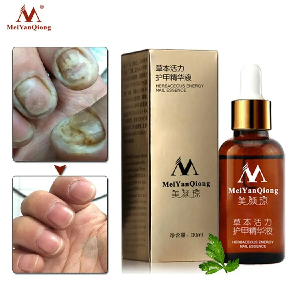 Fungal Nail Treatment Feet Care Essence Nail Foot Whitening Toe Nail