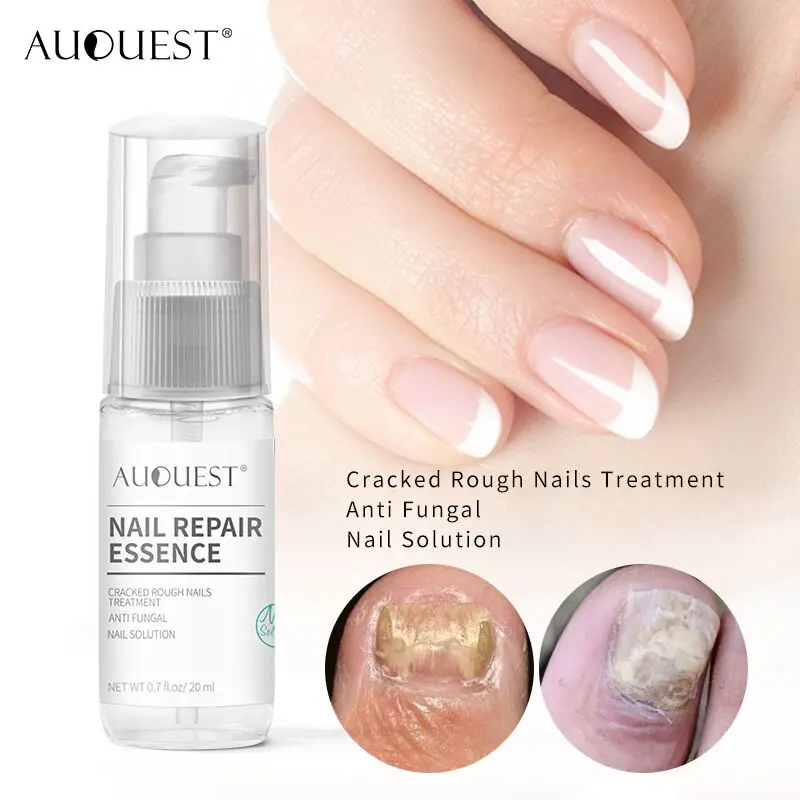 AuQuest Cracked Rough Nail Repair Essence Nail Solution Anti fungal Nail Treatment Foot Scrub