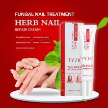 TYJR 15 г травяные Лечение ногтей от грибка травяной крем для ухода за ногтями, ногти для ног "францзуский маникюр" удаление грибка, забота о ногах, анти-грибка ногтей ремонт гель
