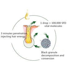 Быстрое средство для роста волос масло имбирного экстракта спрей от выпадения волос MH88