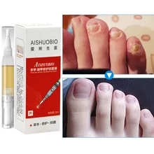 3 мл Onychomycosis ремонт лечение ногтей от грибка эссенция для ногтей и ухода за ногами отбеливающий носок противогрибковый