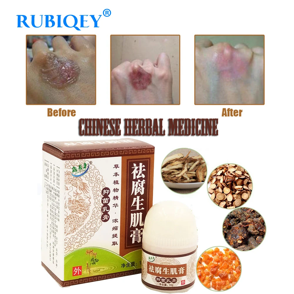 

1PC Herbal Removal Rot Myogenic Cream Bedsores Paste Treat Pressure Sores/Decubituses/Pressure Ulcer Festering Wound Healing