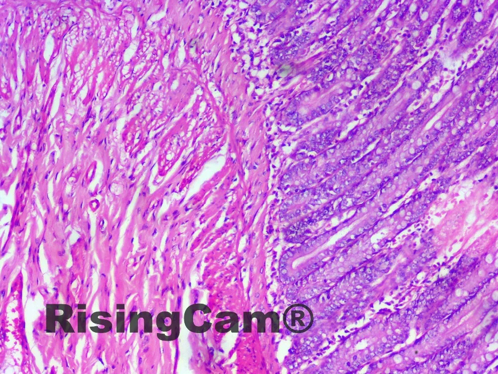 GT12 空肠3-20190509155453043