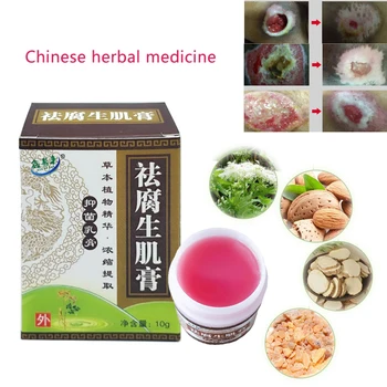 

Chinese Herbal medicine removal rot myogeniccream bedsores paste treat pressure sores ulcer festering wound healing