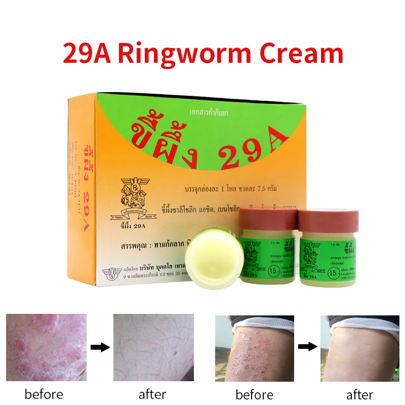 Крем Psoriasi Eczma 2 шт. 29 А идеально подходит для проблем с кожей|cream for psoriasis|cream skincream