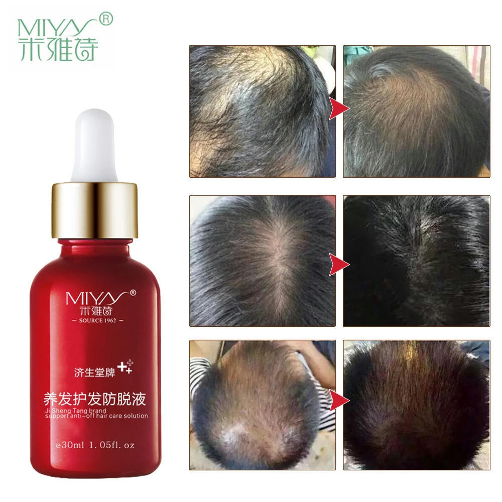 Порошок для роста волос andrea essence против выпадения волос лазер для волос treament hair fall regrowth продукты для мужчин и женщин 30 мл