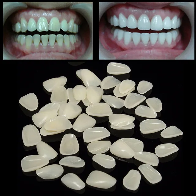 100pcs Dental Temporary Crown Resin Porcelain Materials Anterior Shade