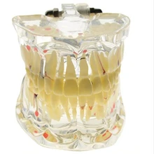 Продвижение стоматологического исследования Зуб Прозрачный взрослый патологические Зубы Модель стоматологическое лабораторное оборудование Обучение стоматолога