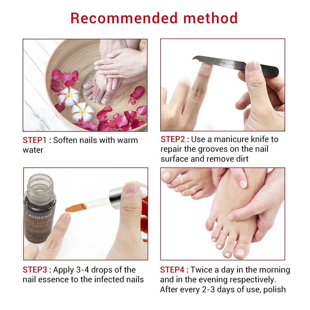 LANBENA Nail Repair Essence Serum Fungal Nail Treatment Remove Onychomycosis Toe Nail Nourishing Brightening Hand And Foot Care LANBENA Nail Repair Essence Serum Fungal Nail Treatment Remove Onychomycosis Toe Nail Nourishing Brightening Hand And Foot Care