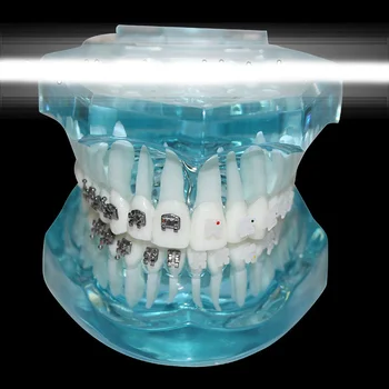 

Semi-metallic semi-ceramic dental orthodontic model oral teaching model patient communication model