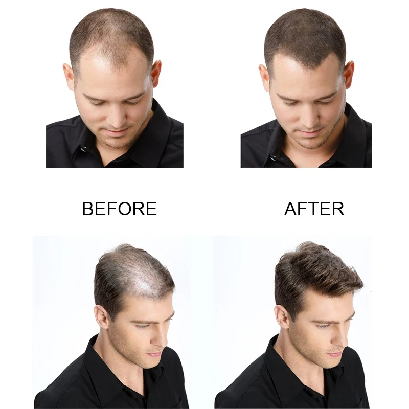 Brand Instantly Full Hair Hair Building Fibers Hair Loss Powder Thicker Hair Care Growth for Men & Women Beauty Products Brand Instantly Full Hair Hair Building Fibers Hair Loss Powder Thicker Hair Care Growth for Men & Women Beauty Products