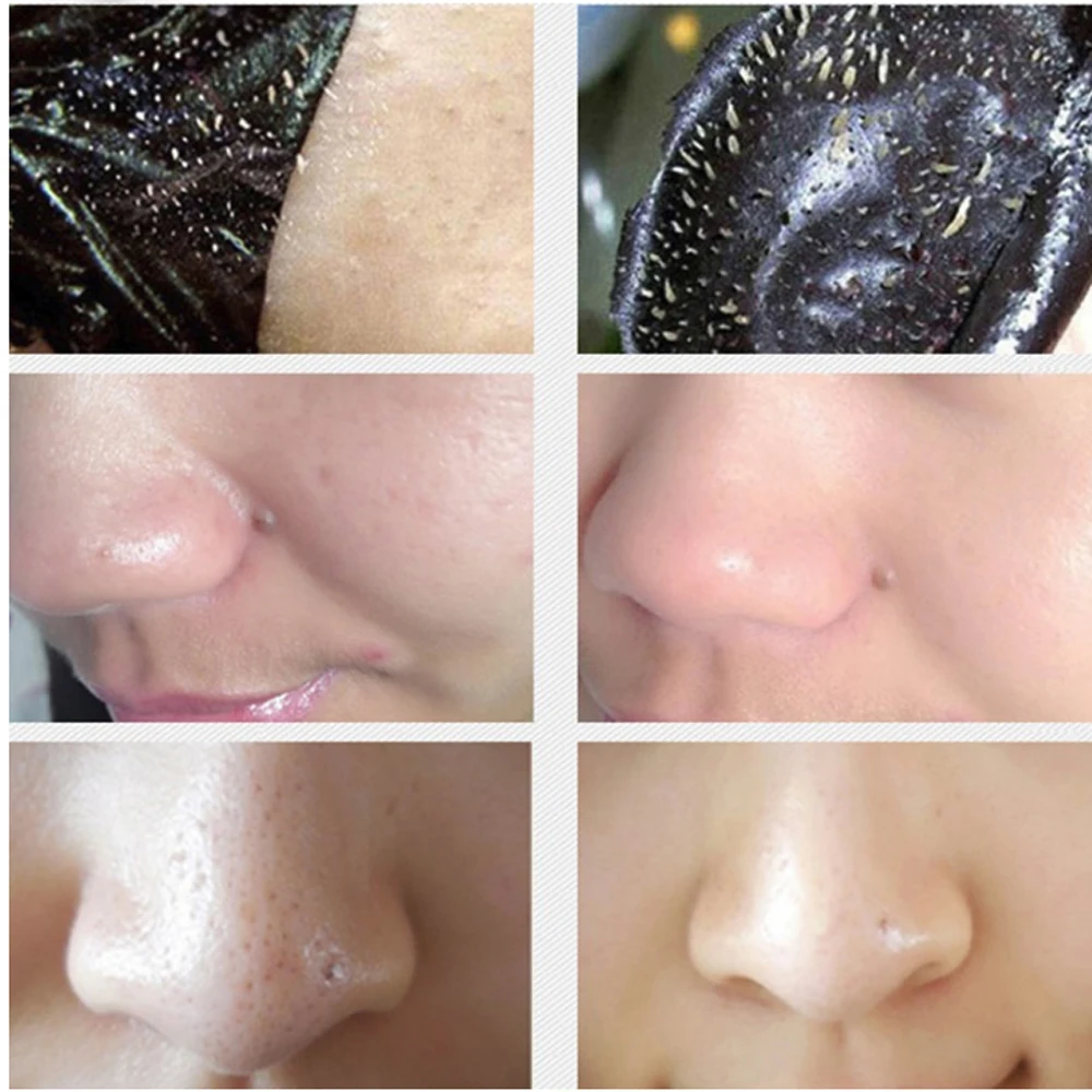 Essence Liquid Blackheads Removal Mask Nasal Membrane Blackhead Remover Strength Fast Fashion Suction Black Head