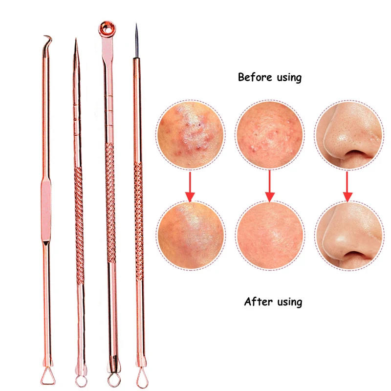 2 set Rose Gold Acne Removal Needles Whitehead Blackhead