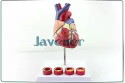 1:1 ЖИЗНЬ Размеры человека анатомический анатомия сердца Спецодежда медицинская модель + тромбоз модель