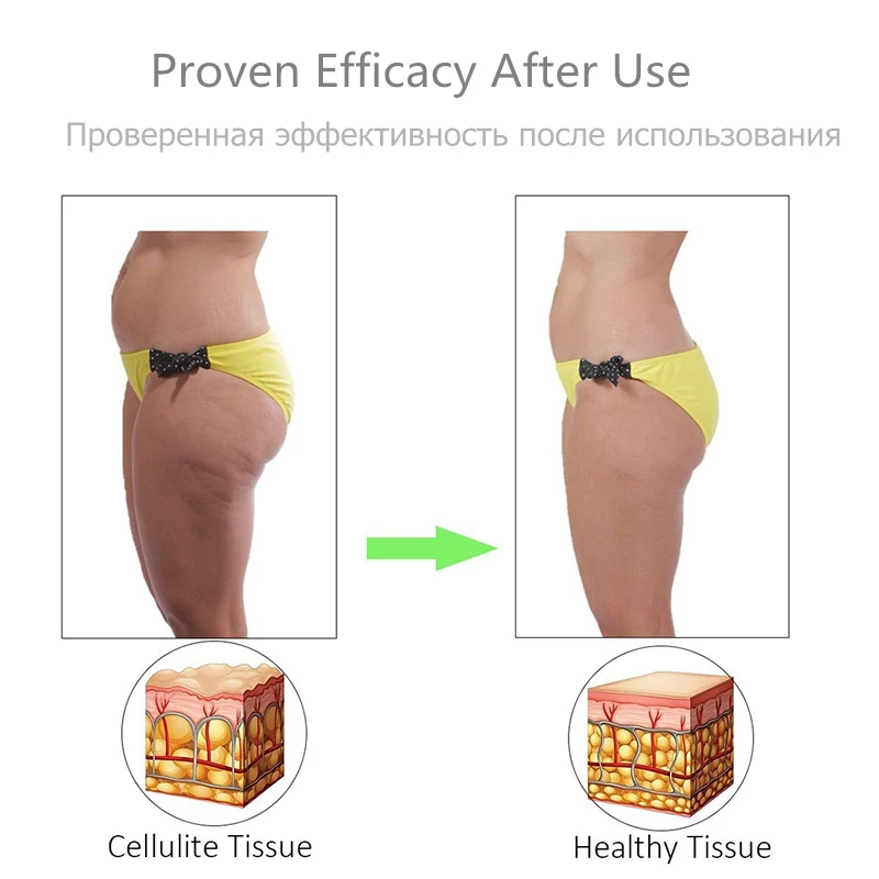 massage roller anti cellulite massage roller anti cellulite