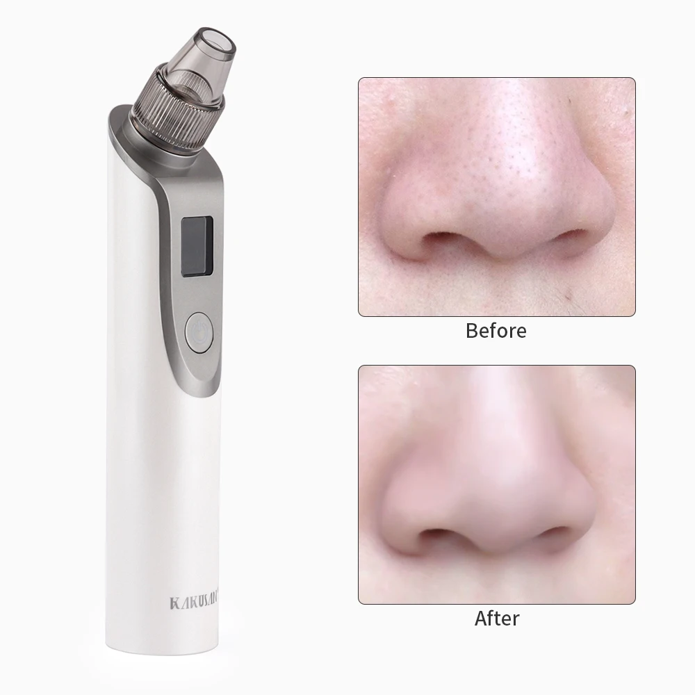 Sucção a Vácuo Cravo Poro Espinha Limpador Facial Acne Removedor Ferramenta Luz Azul Vermelho Profunda Poros Mais Limpo 20 facial cravo acne removedor ferramenta luz azul