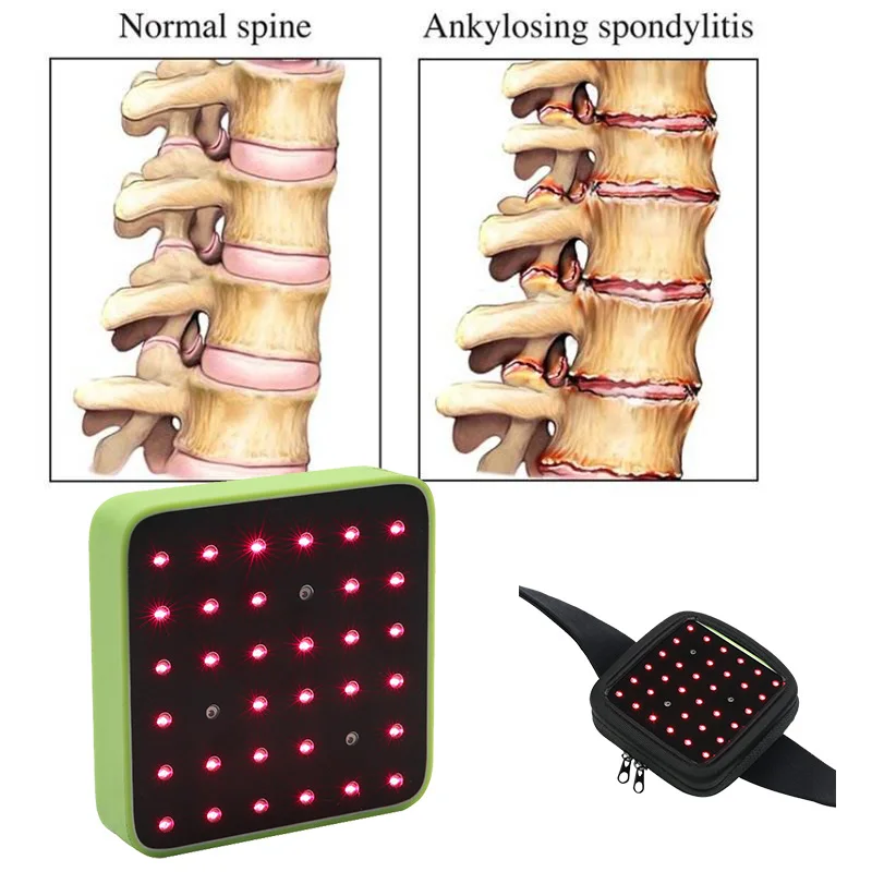 Hot Selling Cold Laser Physiotherapy Back Pain Equipment Knee Pain Arthritis Treatment Waist Foot Neck Pains Freeshippng