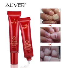 15 г Лечение ногтей от грибка крем Яркий ремонт ногтей Onychomycosis эссенция для удаления ухода за пальцами анти-инфекция здоровье красота инструмент