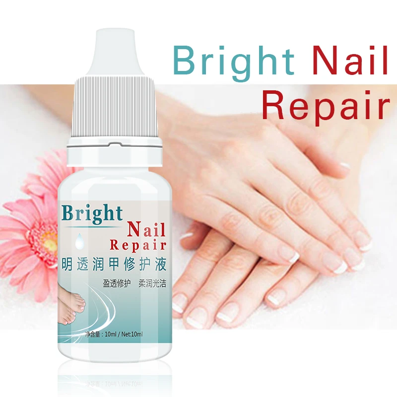 10ml Nail Fungus Treatment Cream Onychomycosis Paronychia Anti Fungal Nail Infection Kills 99.9% Bacteria and Fungus Nail Care