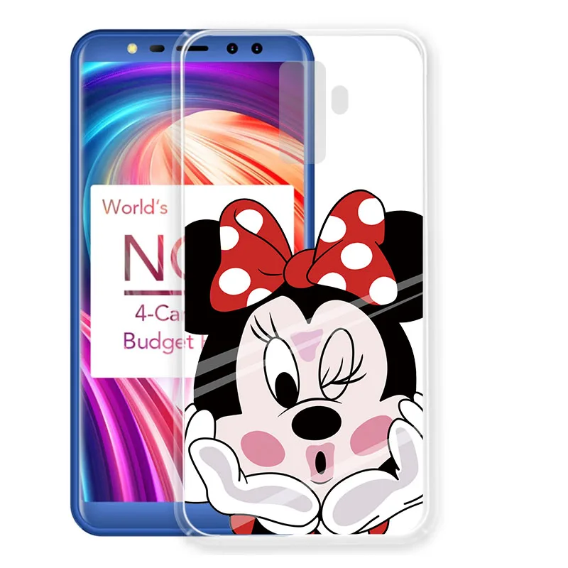 

I am alone Phone Covers For Leagoo M9 5.5 Solf TPU Cellphone Fashion Cute Animals Cases For Leagoo M9