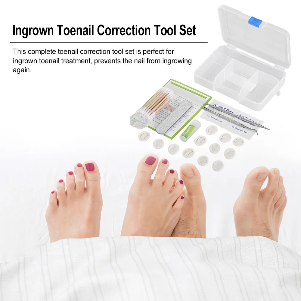 Foot Care Toenail Correction Tool Set Ingrown Toenail Treatment Toenail Straightening Patch