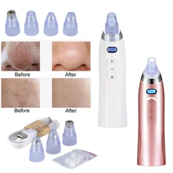 Limpiador de Poros de Cara Removedor de Espinillas Vacío Comedo Succión Diamante Dermabrasión Limpieza Facial Máquina de Belleza para Dama H7Jp Limpiador de Poros de Cara Removedor de Espinillas Vacío Comedo Succión Diamante Dermabrasión Limpieza Facial Máquina de Belleza para Dama H7Jp