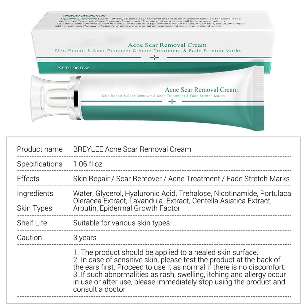 30 г Удаление Шрама от акне крем для лица кожи мазь для лечения шрамов лечение акне, увлажнение крем против мимических морщин угрей Лечение Уход за кожей
