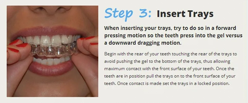 teeth-whitening-kit-3