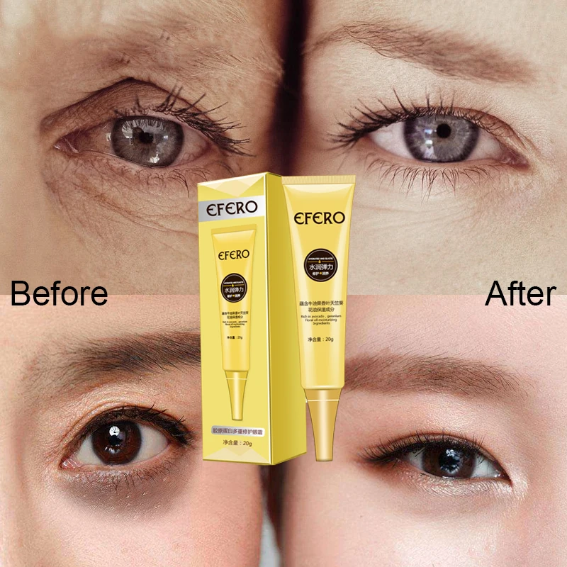 EFERO Anti Winkles Eye Cream Skin Care Hyaluronic Acid Eye Serum Anti-Puffiness Dark Circle Anti-Aging Moisturizing Eye Cream