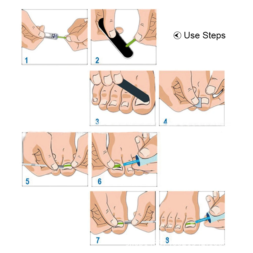 Инструмент для чистки вросших пальцев коррекция ногтей фиксатор восстановление набор патчей с узоры для ногтей Paronychia металлический зажим для ногтей ногти ногтей