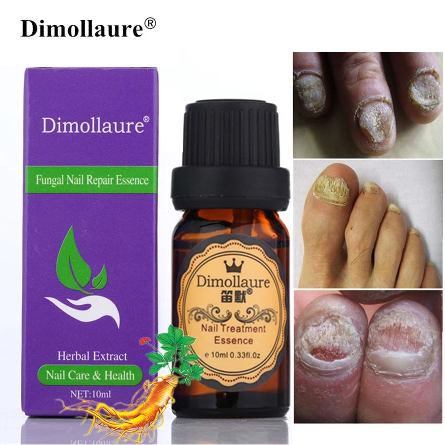 Dimollaure Лечение грибка ногтей Уход за ногами эссенция для ног гладкий носок удаление грибка ногтей гель против инфекции онихомикоз