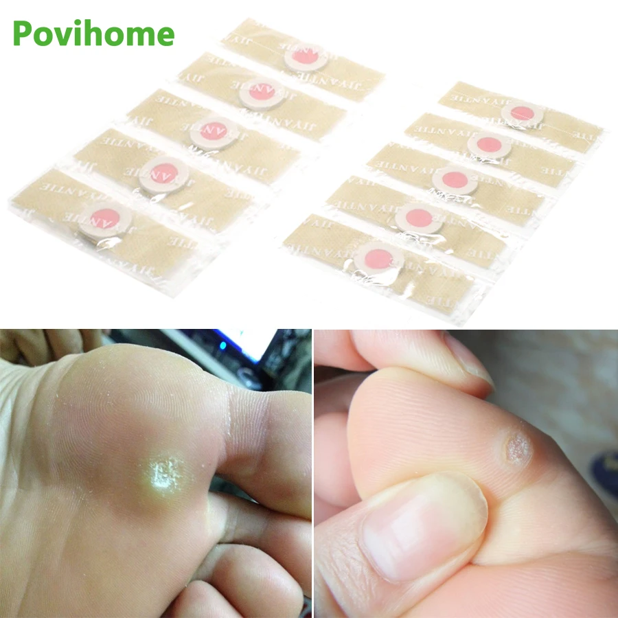 

36pcs Foot Corn Remover Plaster Detox Foot Pad Patches Medical Patch Relieving Blisters&Corn Friction Pain Foot Care Tools D0976