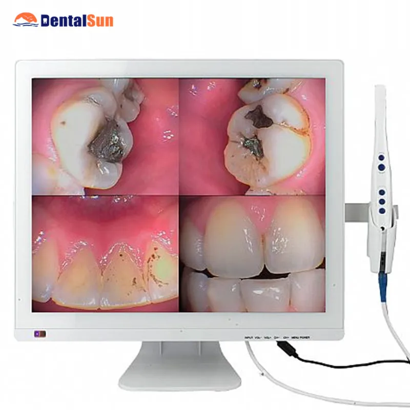 Одобрено FDA Intraoral камера автономный 19 дюймовый светодиодный монитор