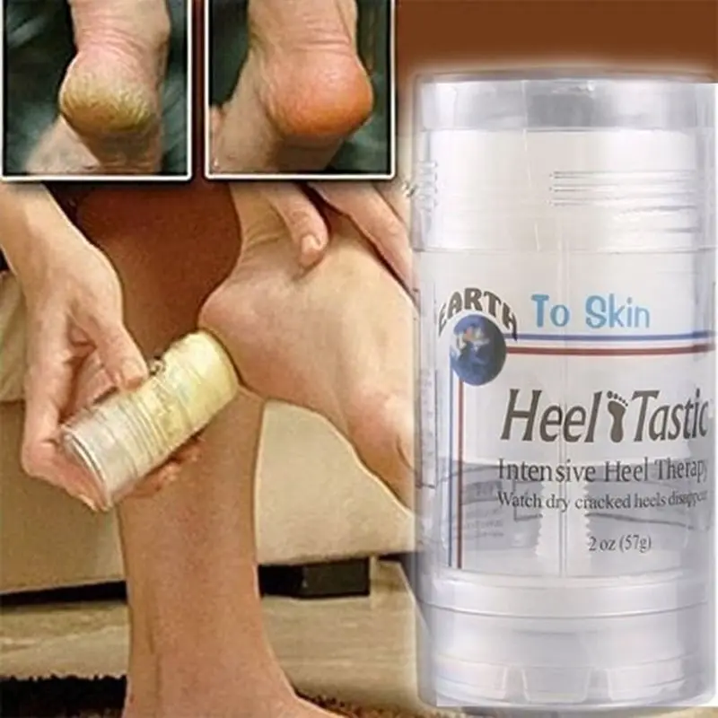 Пятки ног питают против грибков сухой трещин ремонт анти-сушки обморожения крем для удаления омертвевшей кожи уход за кожей