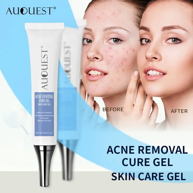 

AuQuest Acne Removal Cure Gel Scar Marks Acne Treatment Repair Comedone Pimple Cleaning Cream Blackhead Remover Skin Care