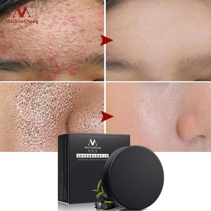 

Activated Charcoal Crystals Handmade Soap Face Skin Whitening Soap Remove Blackhead And Oil Control Washing Face Soap Skin Care