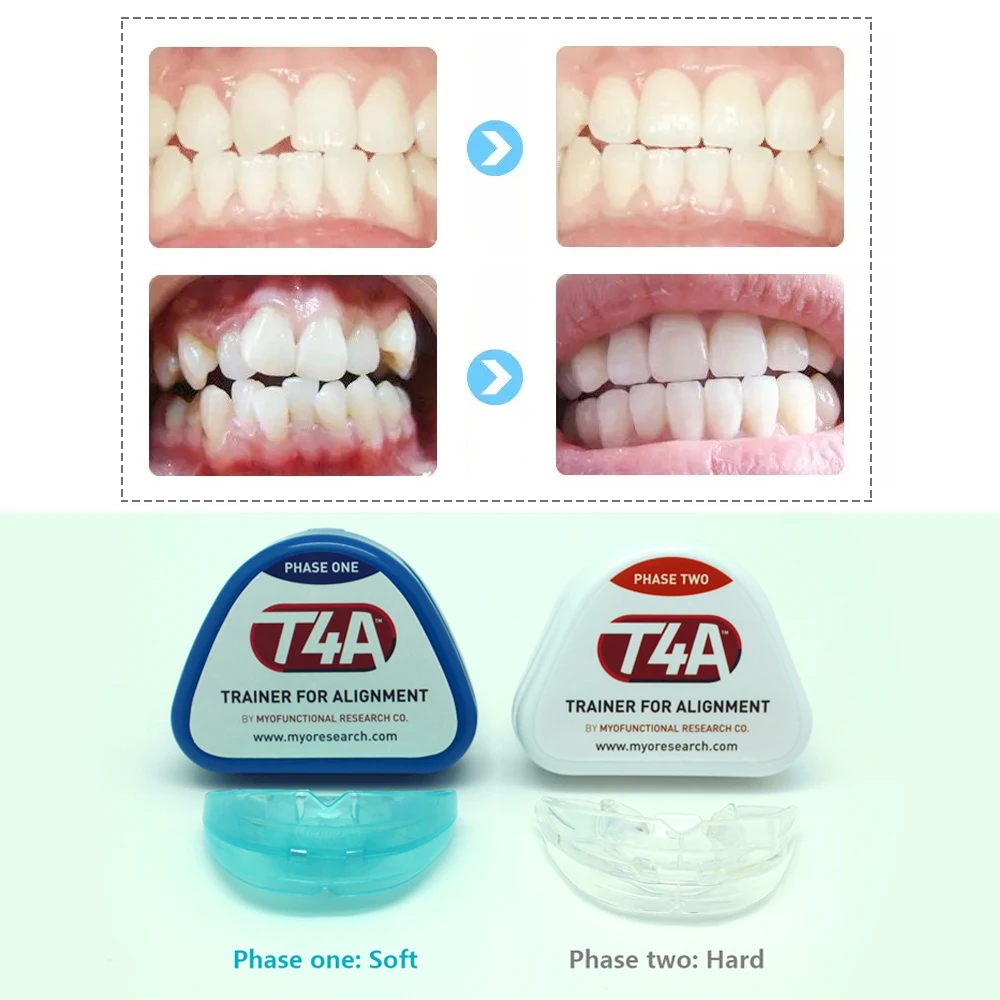 T4A Dental Orthotics Teeth Whitening Tool Tooth ...