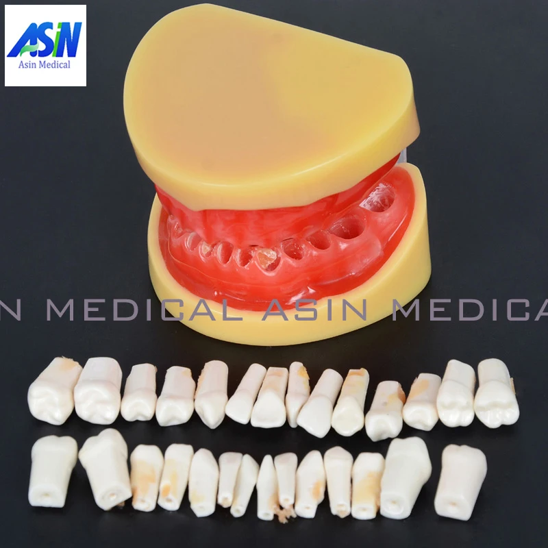 Dental All teeth Removable Standard Teeth Tooth Model 28 pcs teeth student learning model Dental All teeth Removable Standard Teeth Tooth Model 28 pcs teeth student learning model