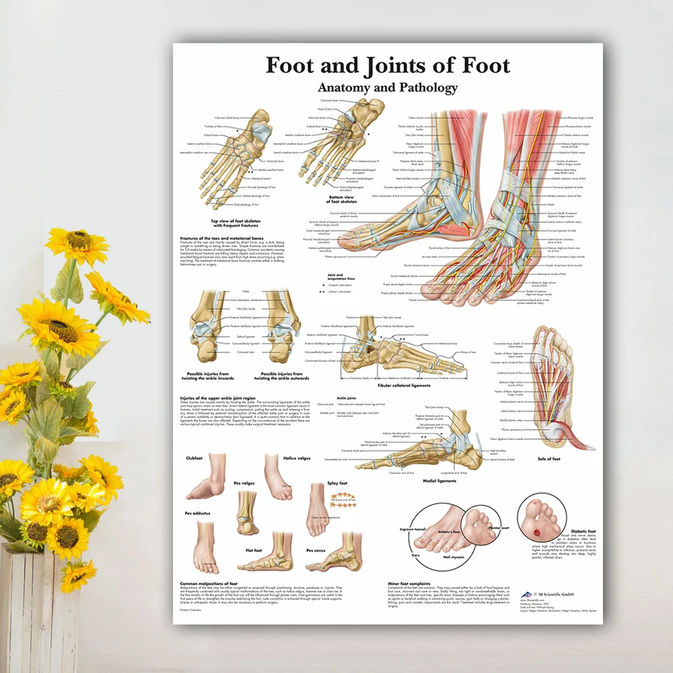Foot Joints Foot Anatomy Pathology Poster Educational School Retro Kraft Paper