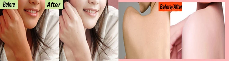 compare skin whitening
