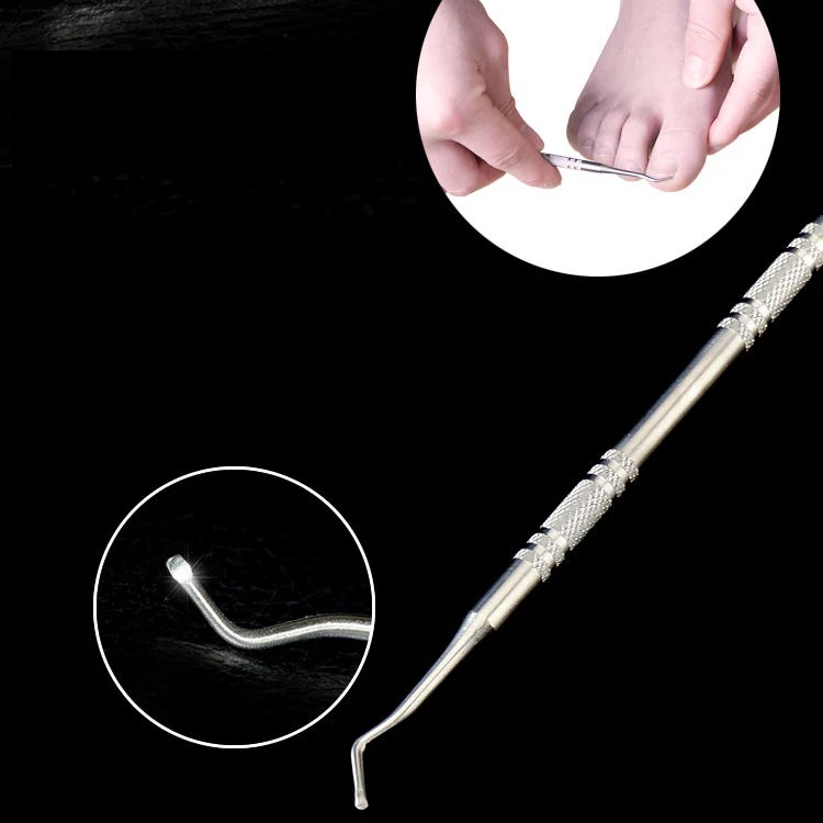 Professional Ingrown Toe Nail Correction Lifter File Clean Installation