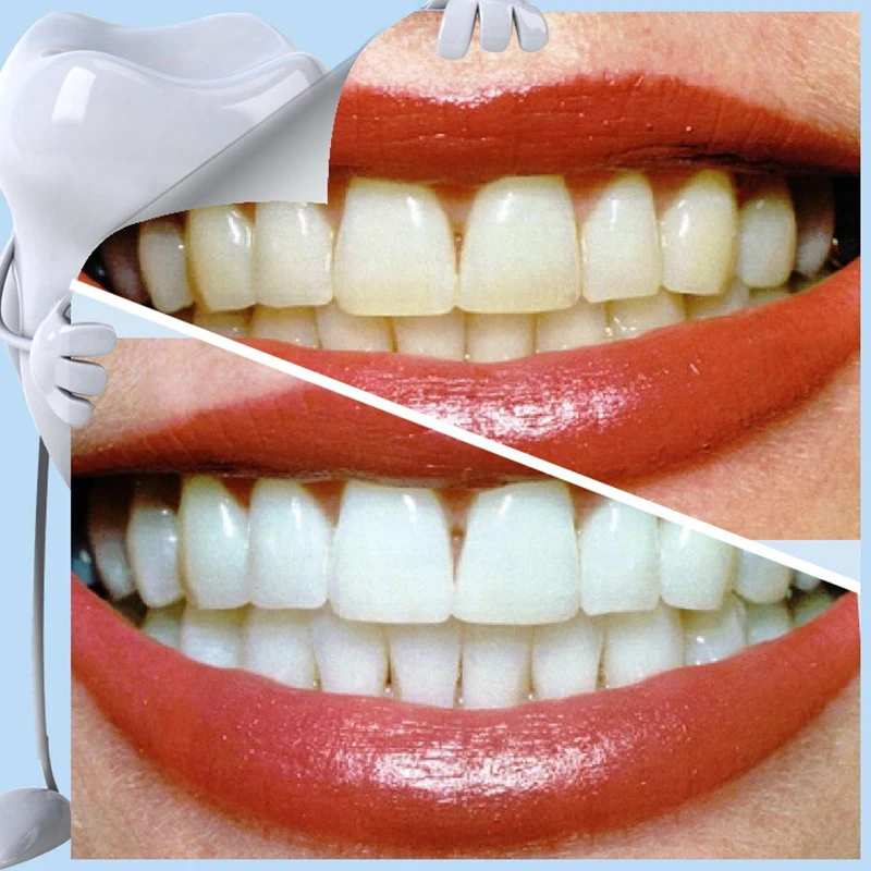 

Teeth Whitening Kit Cleaning Stains Bleaching Teeth Tools Kit Whitening Safe Nano-Technology for Oral Deep Clean