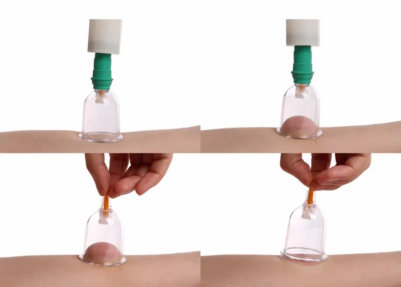 New Arrival 24 Cups Vacuum Magnetic Cupping Sets Traditional Chinese Medicine Medical Home Care Medical Thickened Apparatus -2