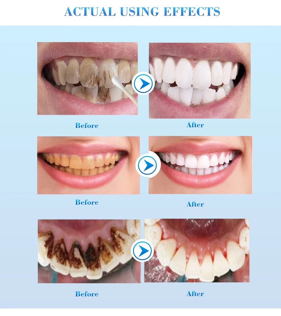EFERO отбеливание зубов пудра с эссенцией гигиена полости рта Очищающая сыворотка удаляет доска пятна Отбеливание зубов зубные инструменты