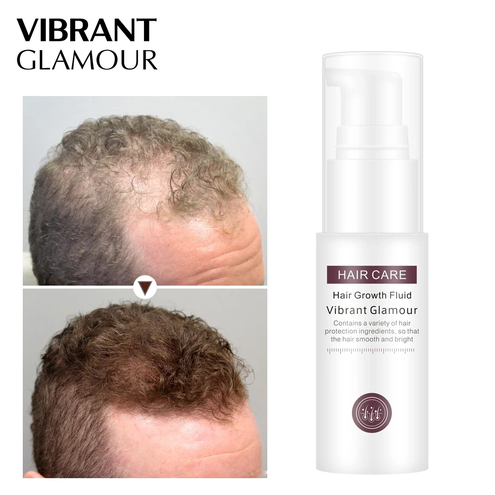 VIBRANTGLAMOUR Hair Growth Essence Essential Oil Liquid Spray Nourish Roots Thick Shiny Prevent hair Loss Anti-hair for Menwomen | Красота и
